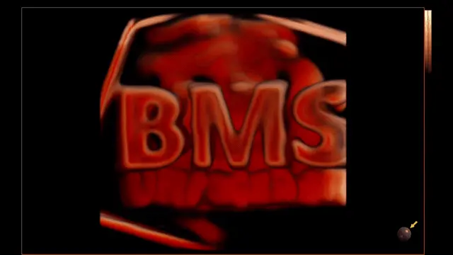 BMS Ultrasonograf